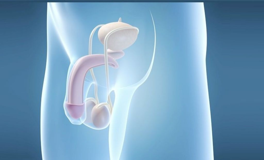 Η εμφύτευση προσθετικής είναι μια χειρουργική μέθοδος μεγέθυνσης του ανδρικού πέους